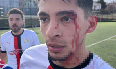 Maç sonrası saha içi savaş alanına döndü, 3 futbolcu hastanelik oldu